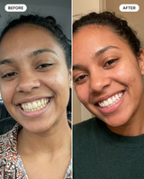 The Complete Smile Bundle view 3