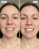 Peroxide-Free Whitening Strips view 4