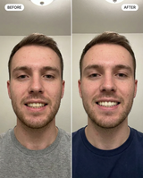 The Complete Smile Bundle view 6