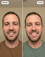 The Complete Smile Bundle view 5